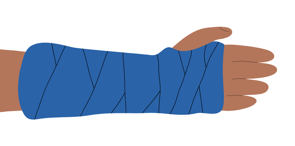 breaks and sprains